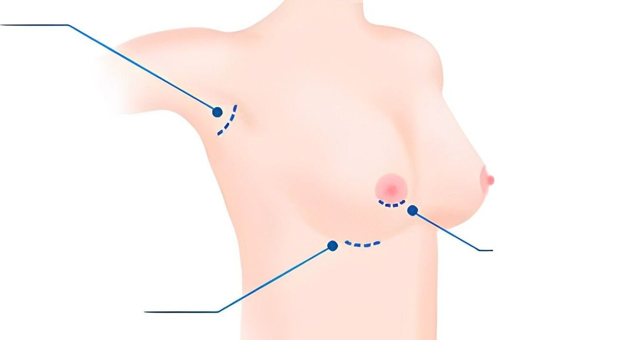 Tipos de tallas para agrandar los senos